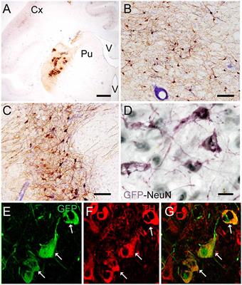 CAV-2-Mediated GFP and LRRK2G2019S Expression in the Macaca fascicularis Brain